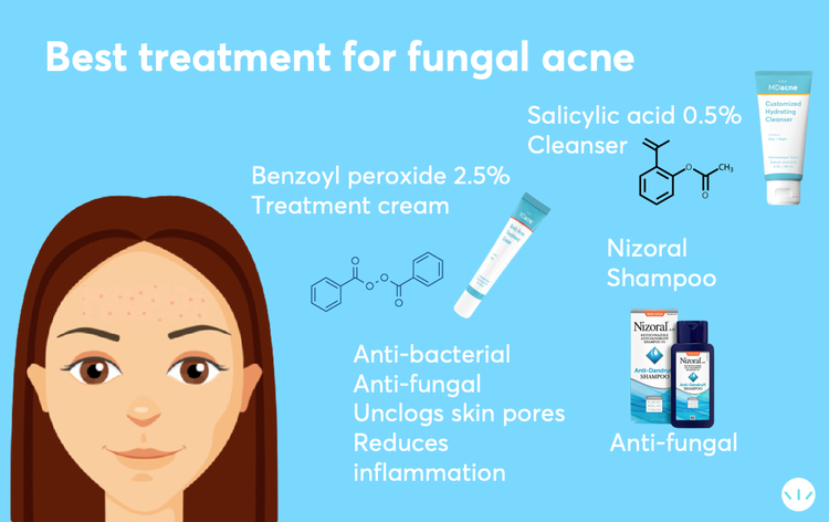 Effective Solutions for How to Get Rid of Fungal Acne in 2025: Discover Proven Methods to Achieve Clear Skin