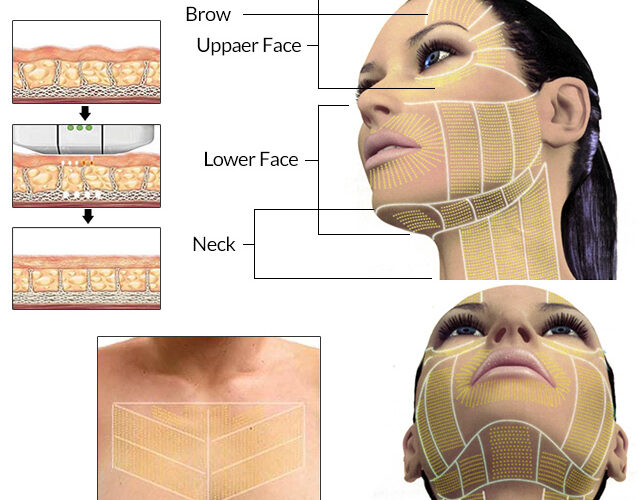 How to Effectively Lose Neck Fat in 30 Days: Practical Tips to Enhance Your Look