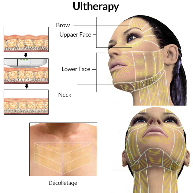 How to Effectively Lose Neck Fat in 30 Days: Practical Tips to Enhance Your Look