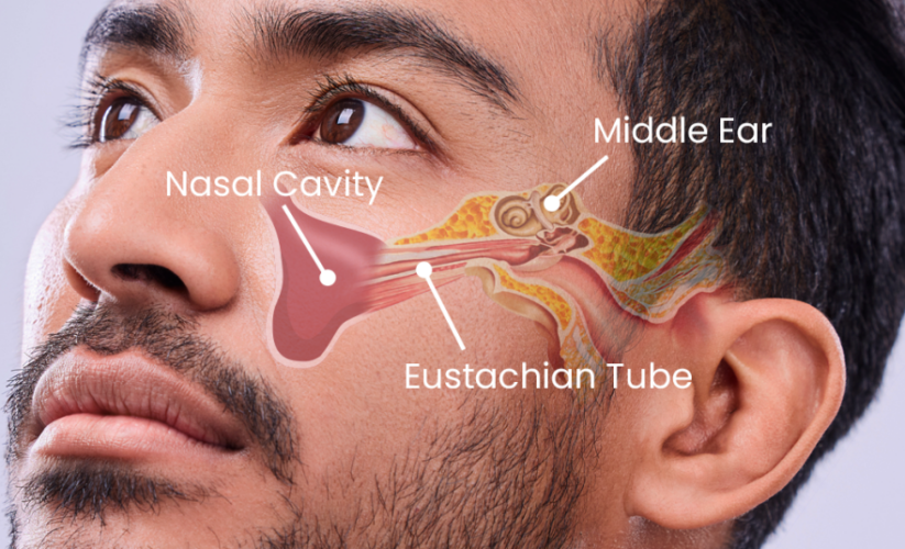 How to Effectively Drain Ear Sinus Fluid for Improved Comfort in 2025