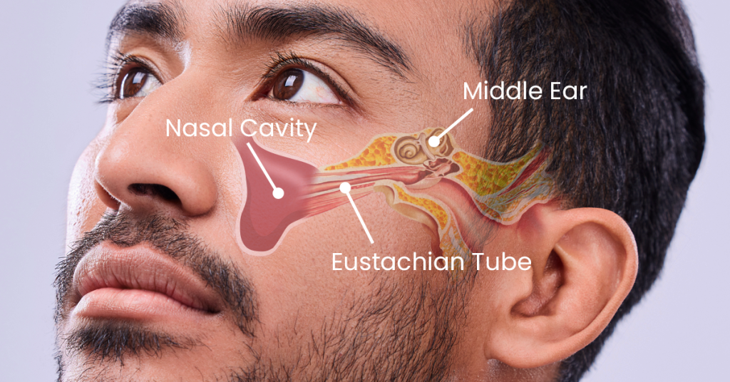 How to Effectively Drain Ear Sinus Fluid for Improved Comfort in 2025